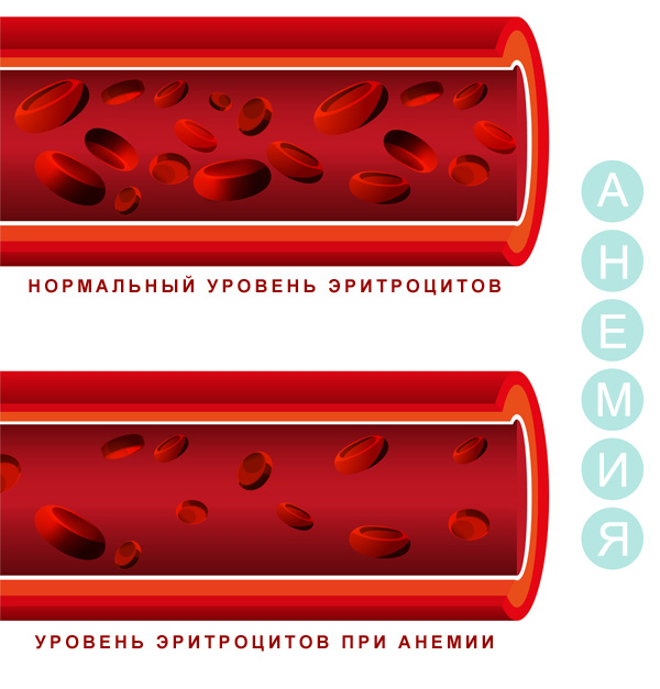 Анемия у собак